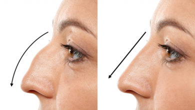 Rhinoplasty in Dubai