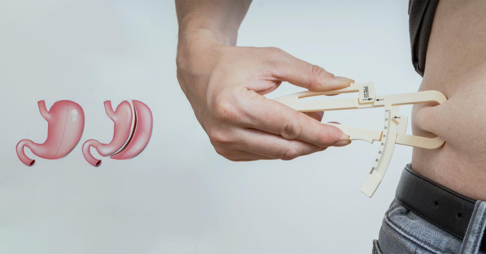 How Weight Loss Surgery Can Improve Your Health and Quality of Life