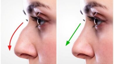 Where to Get Safe Rhinoplasty in Islamabad?